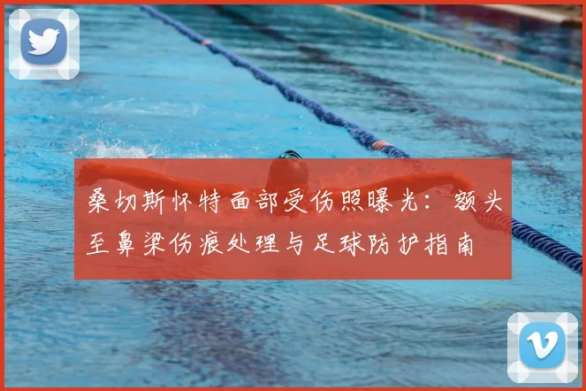 桑切斯怀特面部受伤照曝光:额头至鼻梁伤痕处理与足球防护指南